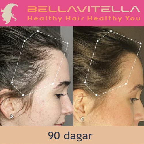 NordicLight Brush | Friskare & Fylligare Hår